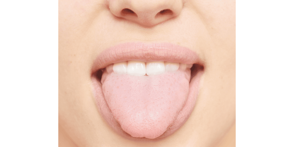 Tongue